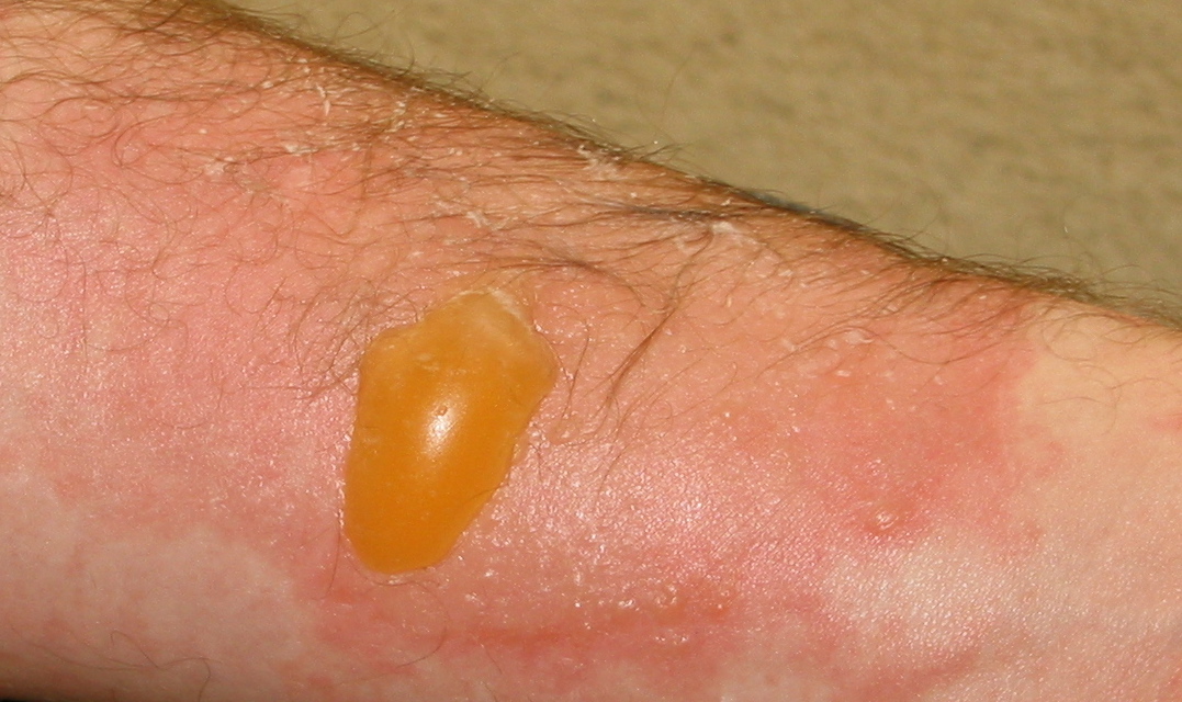 10 способов, как использовать крем Nivea для красоты