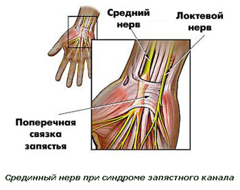 Причины онемения рук