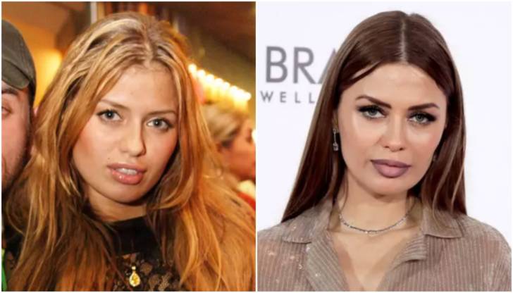 Когда звезды переборщили с губами