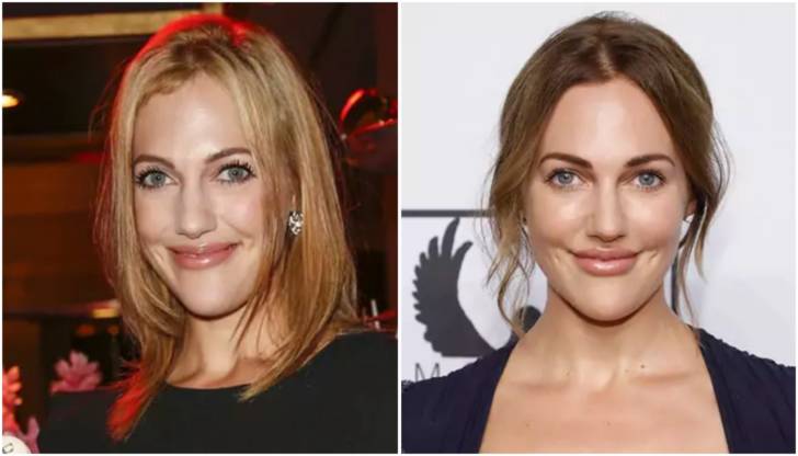 Когда звезды переборщили с губами