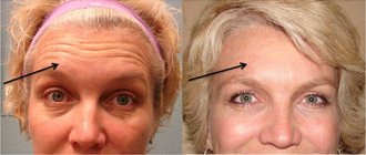 В погоне за молодостью : 6 вещей, которые могут разоблачить вас