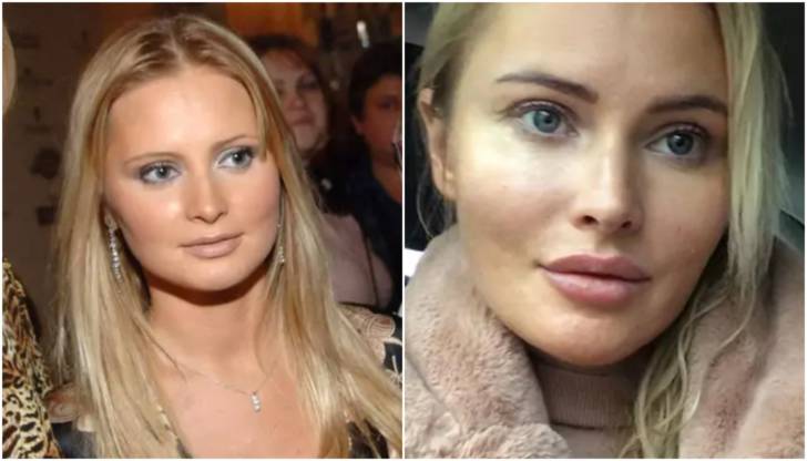 Когда звезды переборщили с губами