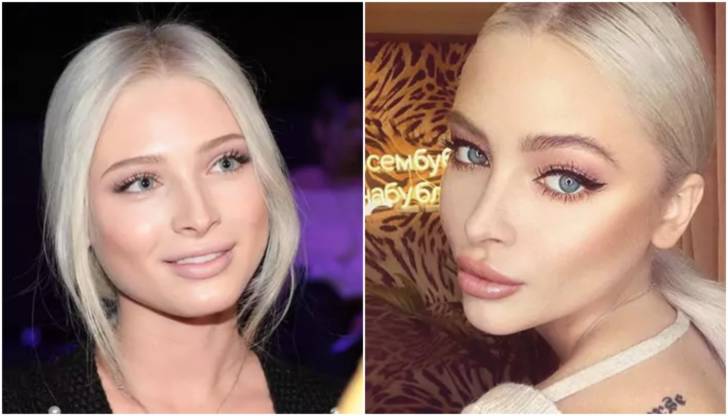 Когда звезды переборщили с губами