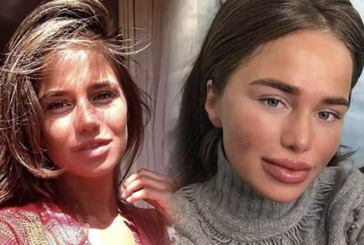 Когда звезды переборщили с губами