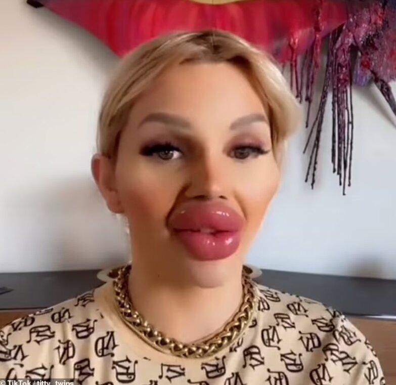 Dziewczyny, które zadały sobie wiele trudu, by uzyskać „piękno”, zdołały je całkowicie roztrwonić.