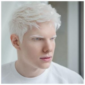 Jak wygląda dziecko tej bajkowej pary: albinos Bera Ivanishvili i jego żona Nanuka Gudavadze. Bajkowa rodzina