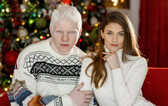Jak wygląda dziecko tej bajkowej pary: albinos Bera Ivanishvili i jego żona Nanuka Gudavadze. Bajkowa rodzina