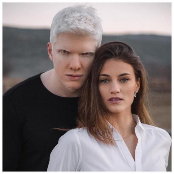 Jak wygląda dziecko tej bajkowej pary: albinos Bera Ivanishvili i jego żona Nanuka Gudavadze. Bajkowa rodzina