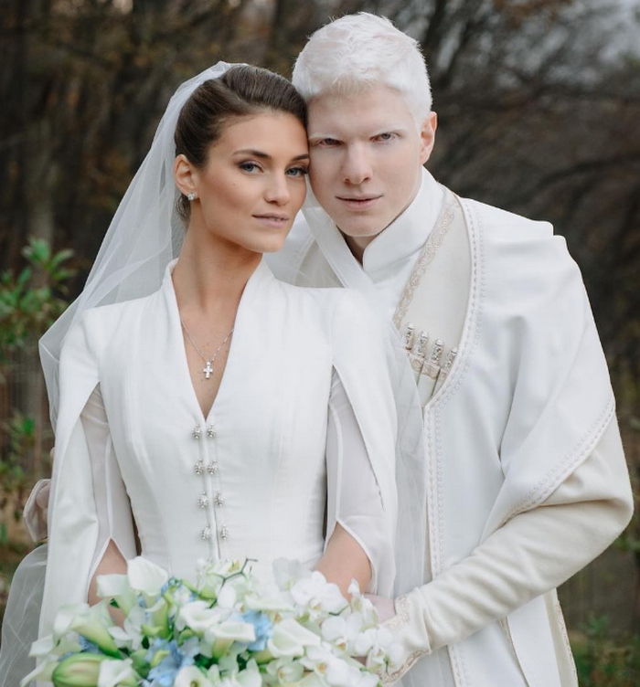 Jak wygląda dziecko tej bajkowej pary: albinos Bera Ivanishvili i jego żona Nanuka Gudavadze. Bajkowa rodzina