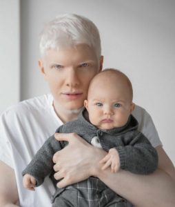 Jak wygląda dziecko tej bajkowej pary: albinos Bera Ivanishvili i jego żona Nanuka Gudavadze. Bajkowa rodzina