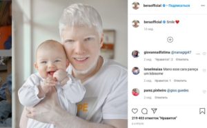 Jak wygląda dziecko tej bajkowej pary: albinos Bera Ivanishvili i jego żona Nanuka Gudavadze. Bajkowa rodzina