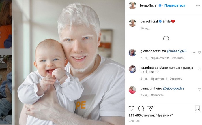 Jak wygląda dziecko tej bajkowej pary: albinos Bera Ivanishvili i jego żona Nanuka Gudavadze. Bajkowa rodzina