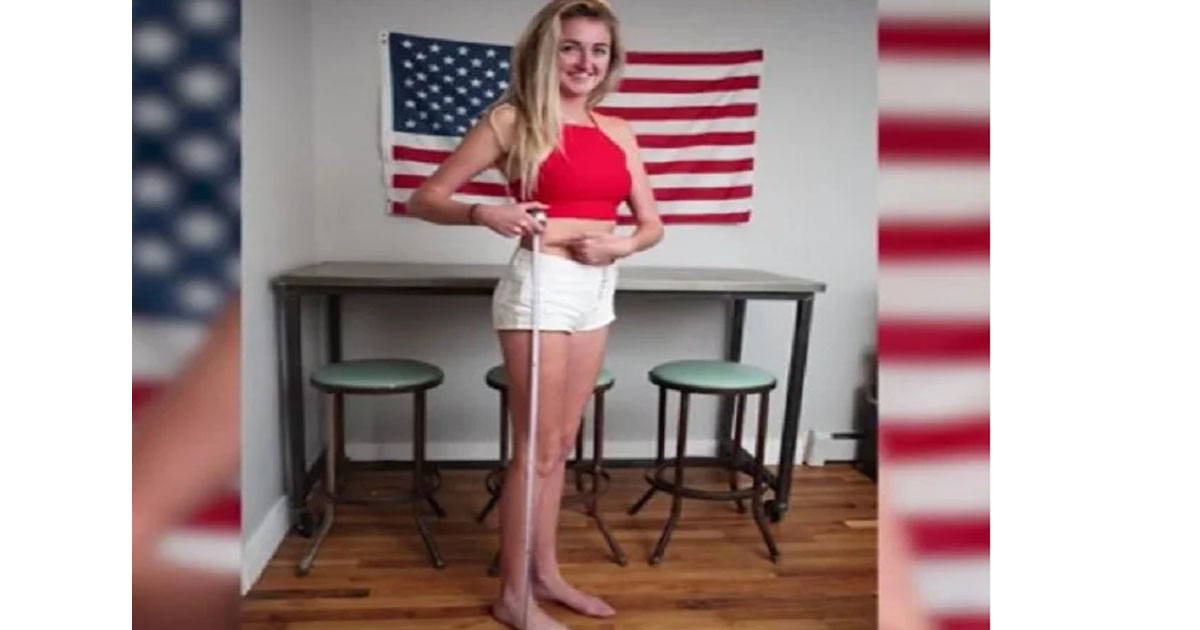 Dziewczynce po lewej stronie dokuczano w szkole jako żyrafie. Minęło 8 lat i teraz każdy chce zrobić sobie z nią zdjęcie!