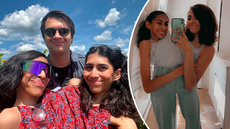 „Myślę, że jesteśmy dwiema różnymi osobami!” - te bliźniaczki syjamskie mają po dwadzieścia trzy lata. Lupita i Carmen były nieustannie pytane o to, jak budują relacje i dzielą się mężczyznami