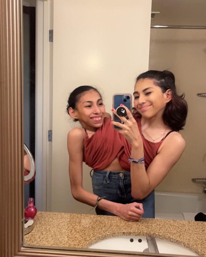 „Myślę, że jesteśmy dwiema różnymi osobami!” - te bliźniaczki syjamskie mają po dwadzieścia trzy lata. Lupita i Carmen były nieustannie pytane o to, jak budują relacje i dzielą się mężczyznami