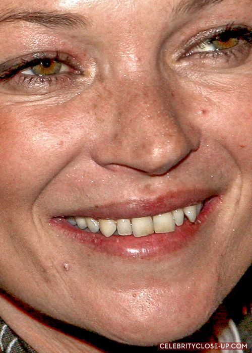 Zmarszczki na całej twarzy, próchnica zębów i brak makijażu na twarzy. Słynna modelka, która w wieku 49 lat bardzo się postarzała i nie jest już dla nikogo interesująca.