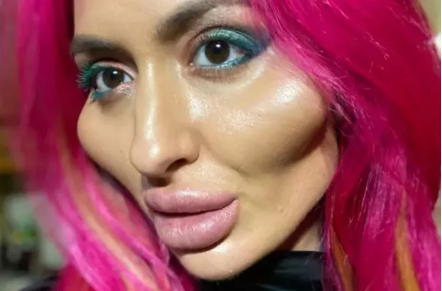 Z powodu dużych kości policzkowych i wydętych ust wcale nie wygląda naturalnie: ukraińska blogerka postanowiła pokazać swoje zdjęcia po zmianie wyglądu