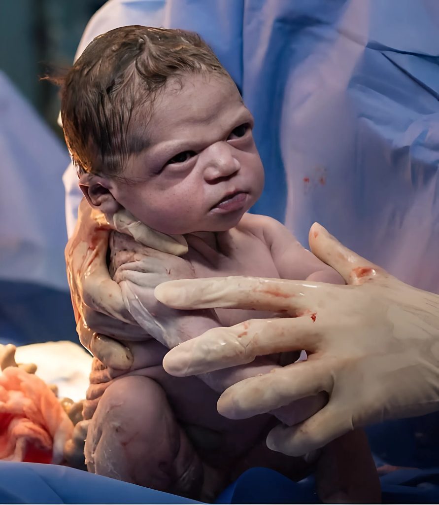 Zdjęcie na sali porodowej tuż po narodzinach Isabelli sprawiło, że dziewczynka stała się bohaterką bloga swojej mamy