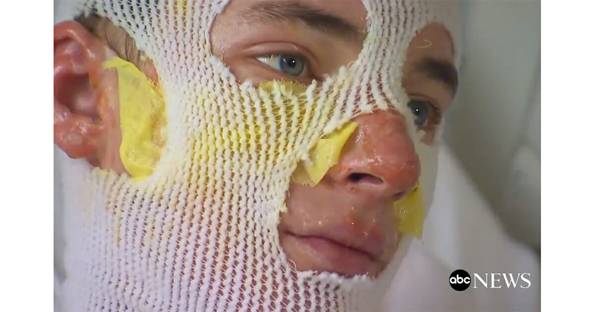 Wujek doznał poparzeń trzeciego stopnia po tym, jak rzucił się do płonącego budynku, aby uratować 8-letnią dziewczynkę.