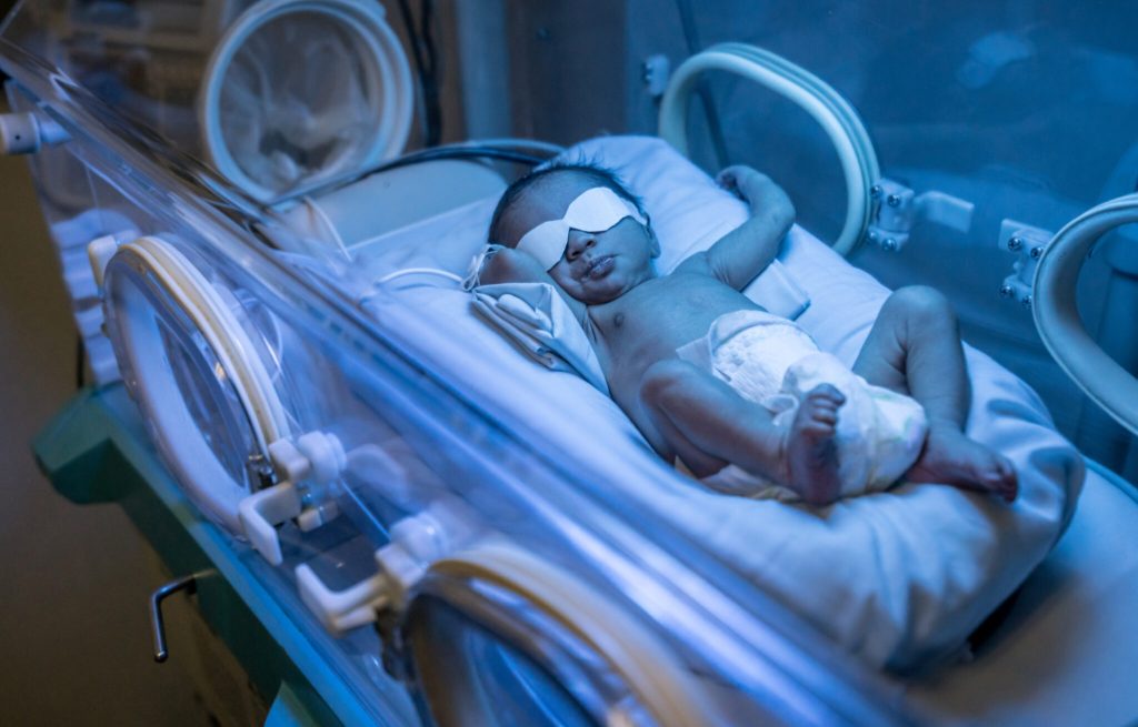 Biała mama po urodzeniu czarnego dziecka, ale jej mąż jest biały