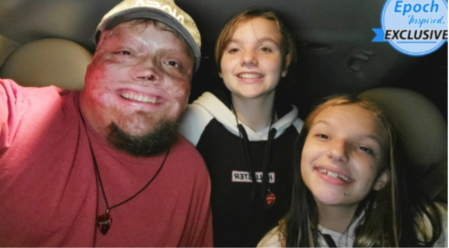 On i dzieci zostali porzuceni przez żonę. W dzieciństwie został ranny i 98% jego ciała jest poparzone. Jak teraz żyje samotny ojciec