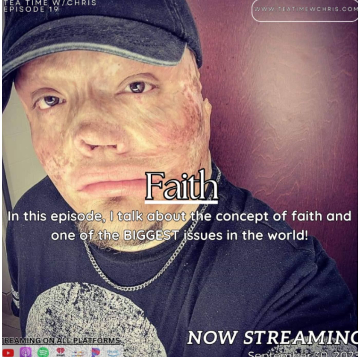 On i dzieci zostali porzuceni przez żonę. W dzieciństwie został ranny i 98% jego ciała jest poparzone. Jak teraz żyje samotny ojciec