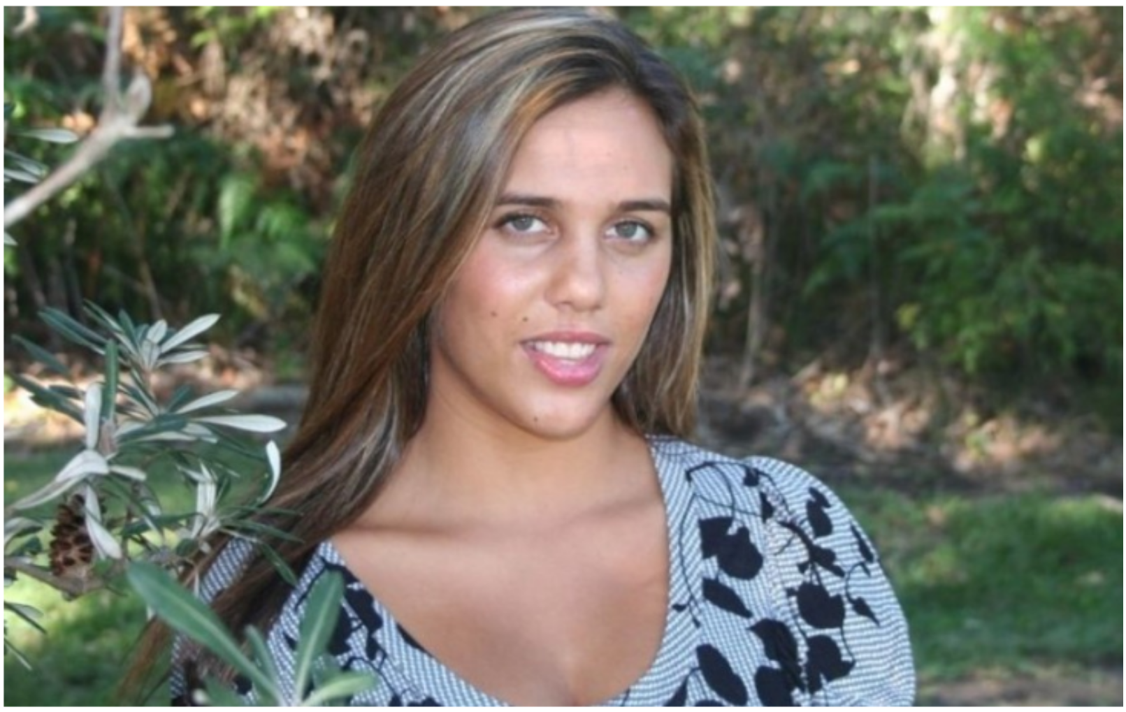 Dwieście operacji, które przywróciły ją do życia. Niesamowita historia australijskiej modelki, która padła ofiarą pożaru.