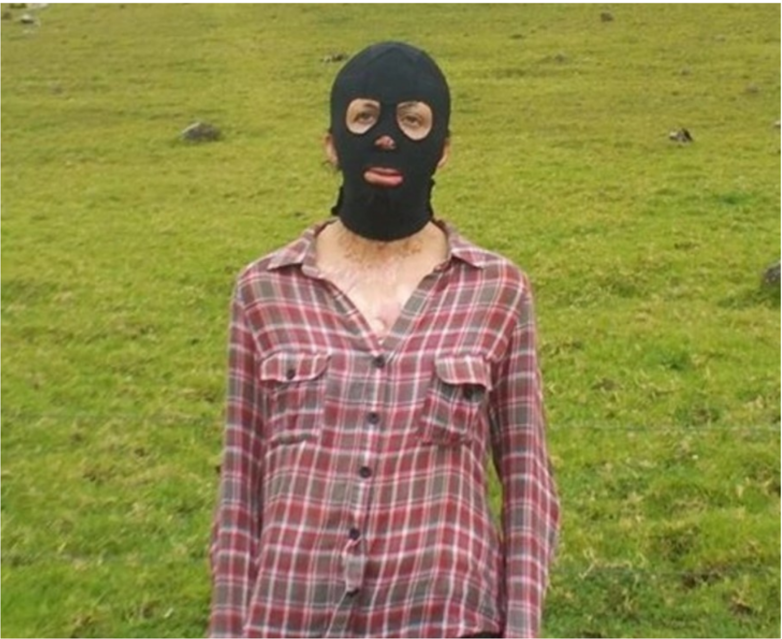 Dwieście operacji, które przywróciły ją do życia. Niesamowita historia australijskiej modelki, która padła ofiarą pożaru.