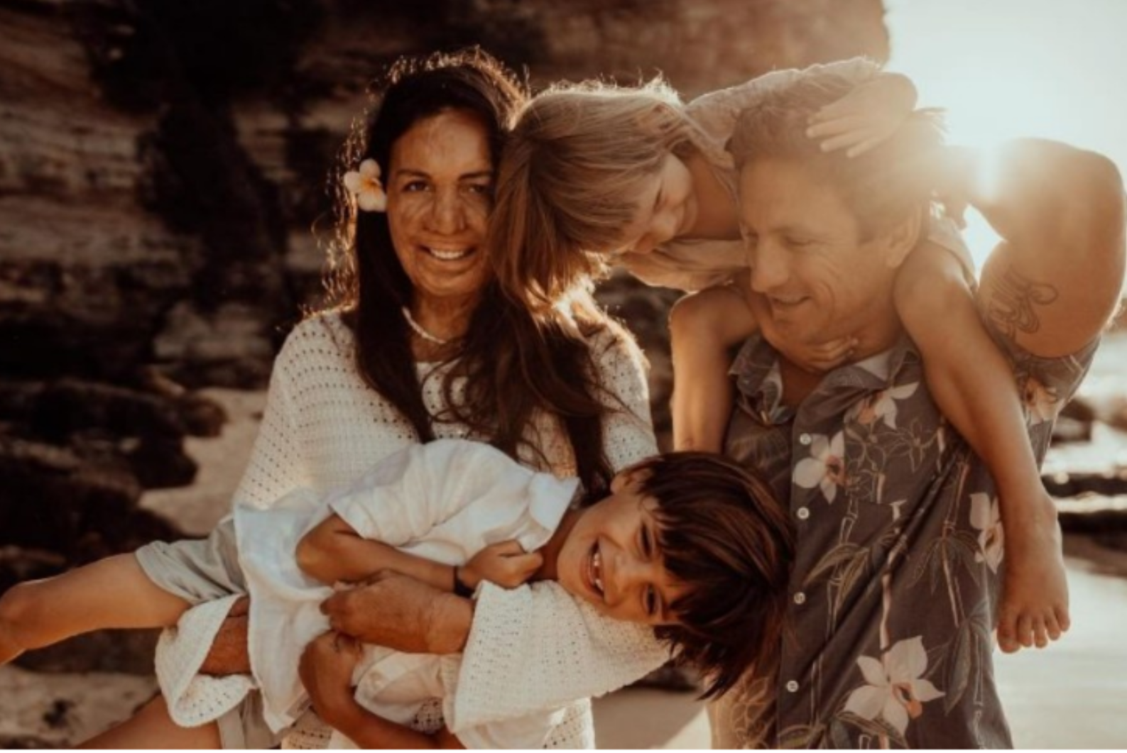 Dwieście operacji, które przywróciły ją do życia. Niesamowita historia australijskiej modelki, która padła ofiarą pożaru.