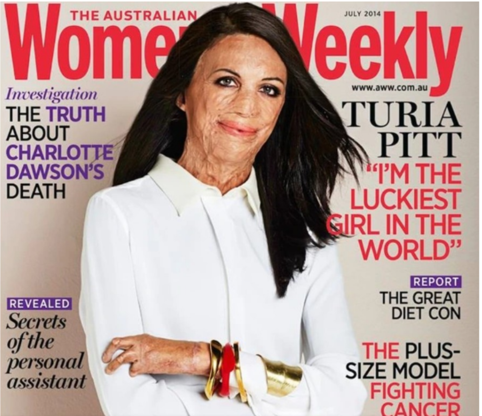 Dwieście operacji, które przywróciły ją do życia. Niesamowita historia australijskiej modelki, która padła ofiarą pożaru.