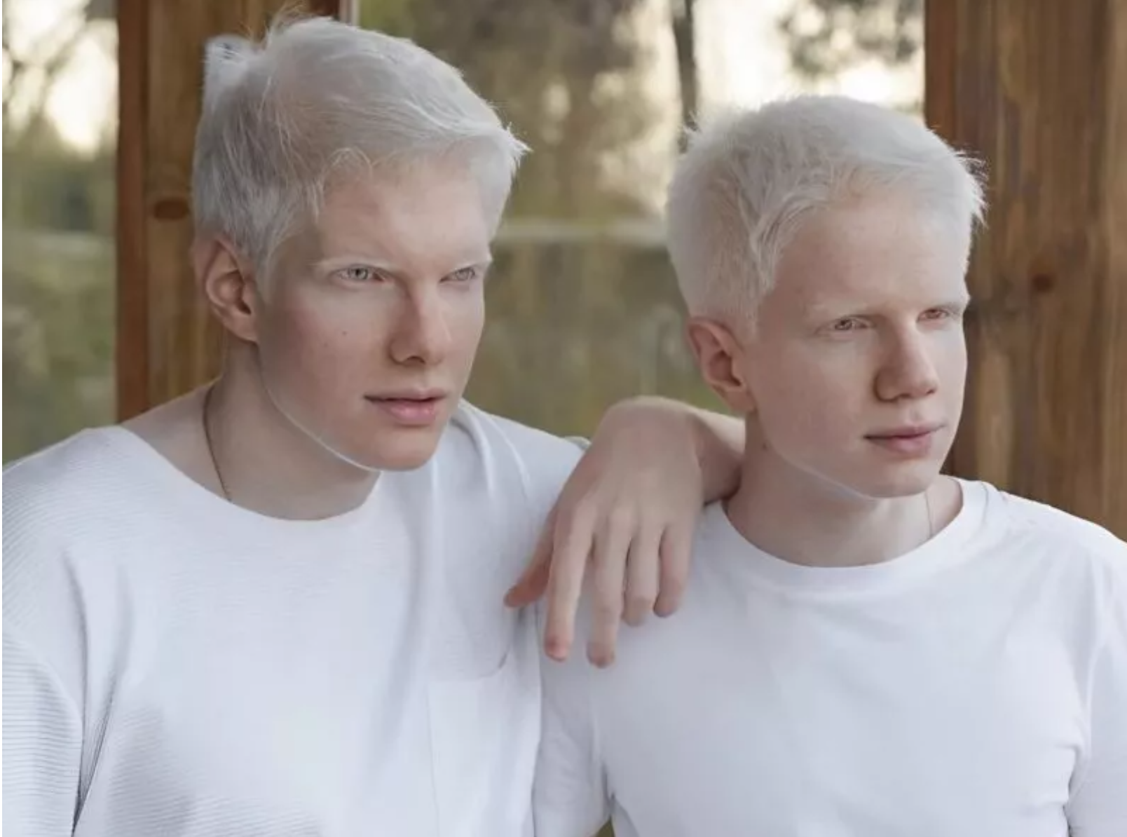 Mężczyzna o rzadkiej urodzie wychowuje dwoje dzieci urodzonych w małżeństwie z modelką.