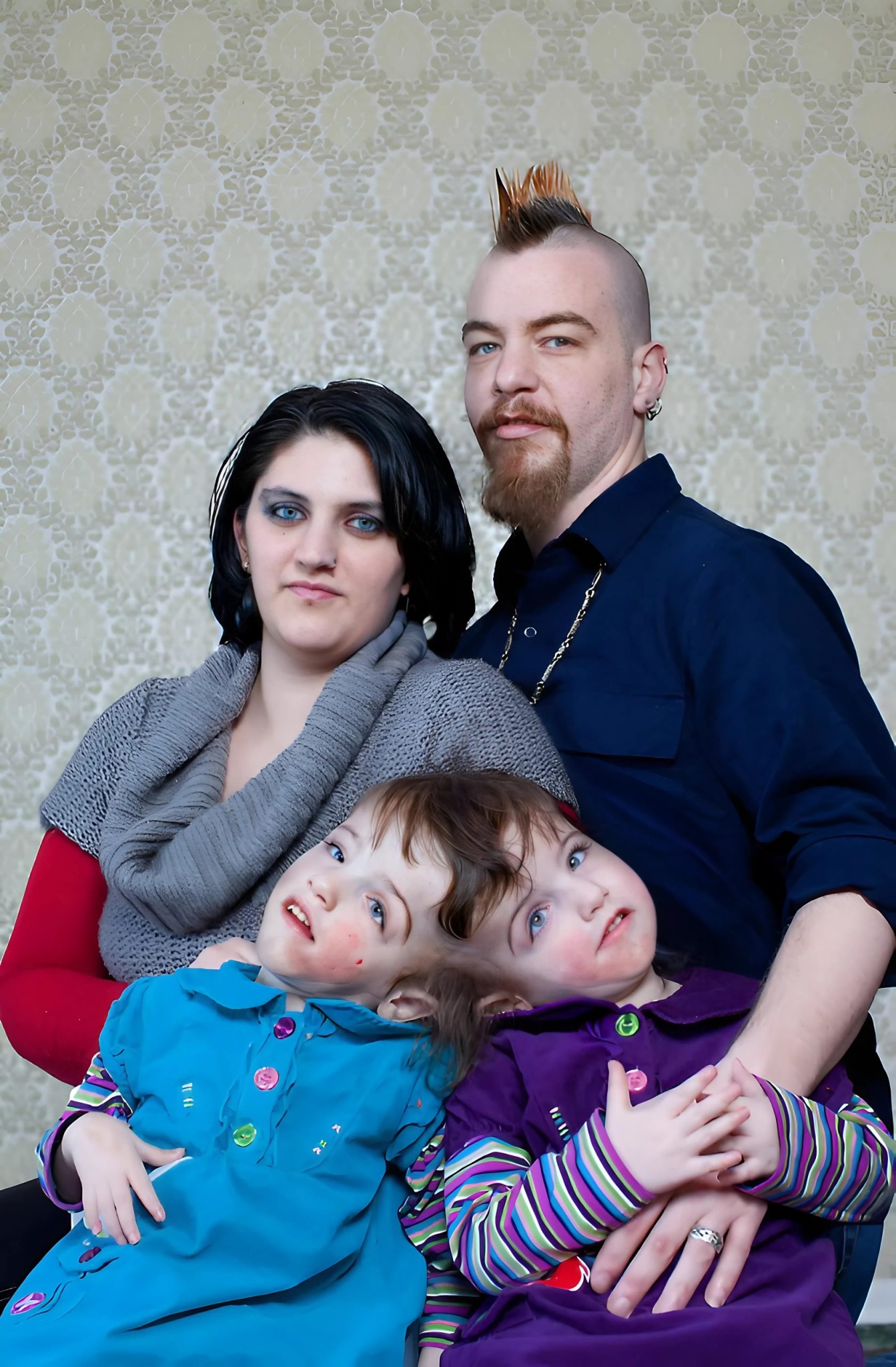 Siostry miały zrośnięte głowy, ale mimo to udało im się dożyć pełnoletności.