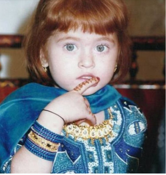 W dzieciństwie wyśmiewano ją z powodu nietypowego wyglądu. A co stało się później?