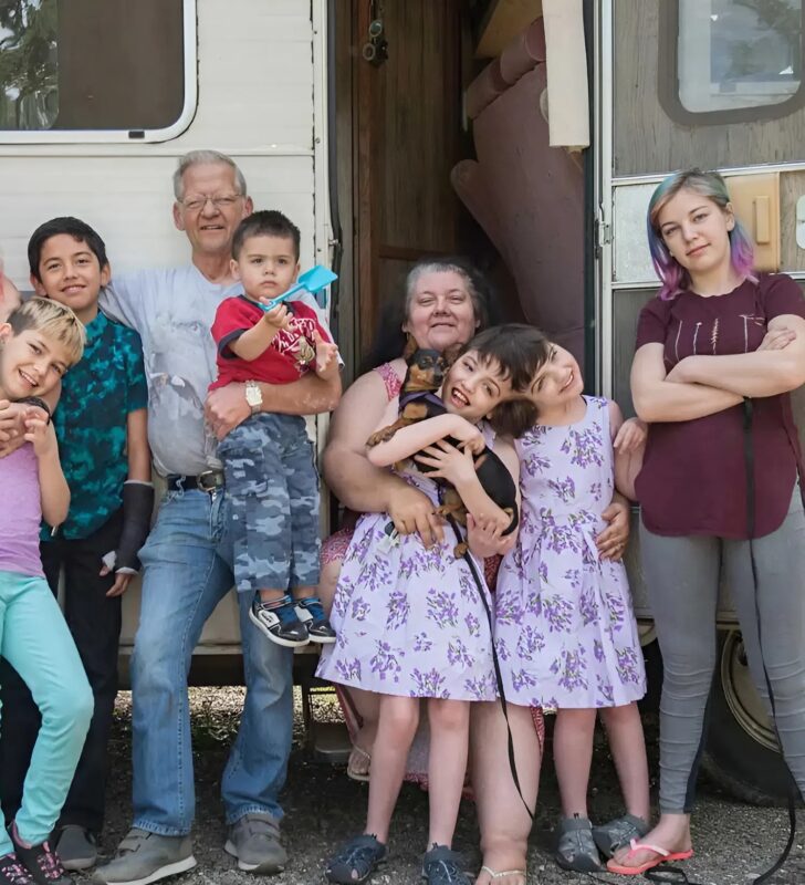 Siostry miały zrośnięte głowy, ale mimo to udało im się dożyć pełnoletności.