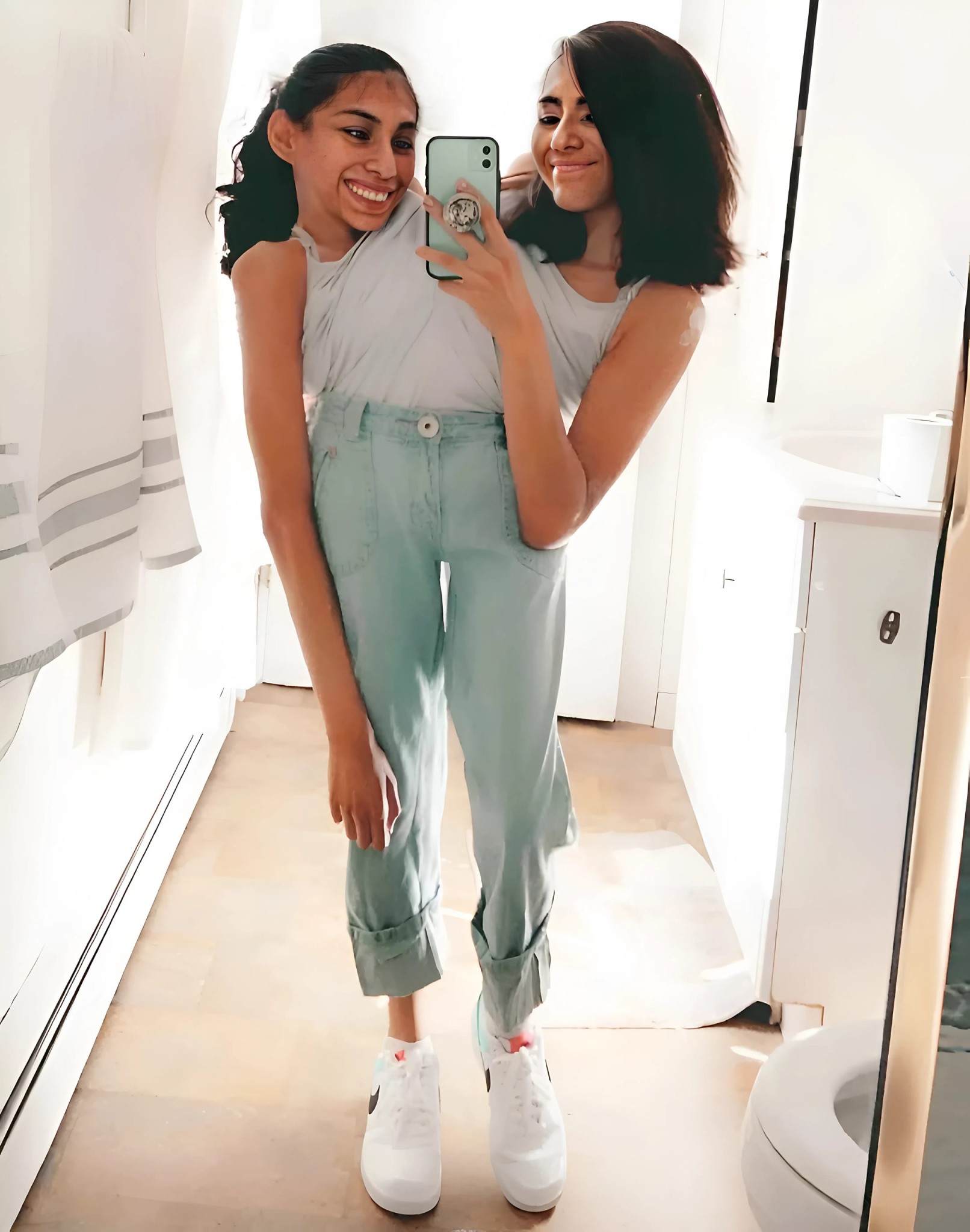 Te syjamskie bliźniaczki były zrośnięte w okolicy brzucha, ale znalazły swoje szczęście i wyszły za mąż za jednego faceta. Oto jak wygląda.