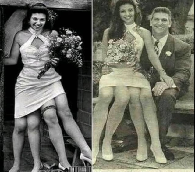 Kobieta z czterema nogami. Niezwykła historia z niecodziennym zakończeniem