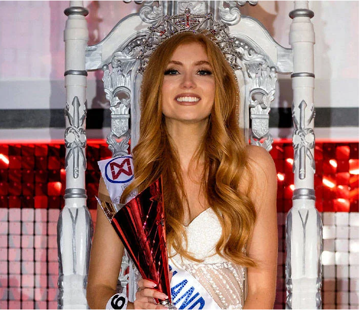 Miss Anglii. Czy uwierzycie, że kiedyś w szkole wyśmiewano ją z powodu rudych włosów?