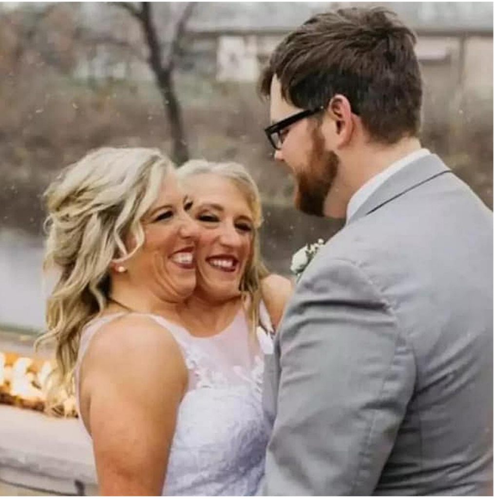 Tym syjamskim bliźniaczkom udało się wziąć ślub z jednym mężczyzną. Czy udało im się stworzyć szczęśliwą rodzinę?