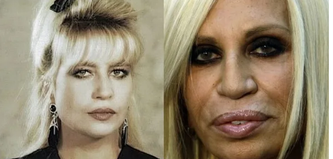 „Trudno w to uwierzyć, ale była piękna”: jak wyglądała włoska projektantka mody Donatella Versace przed operacją plastyczną?