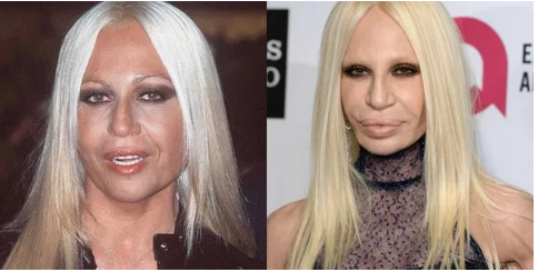 „Trudno w to uwierzyć, ale była piękna”: jak wyglądała włoska projektantka mody Donatella Versace przed operacją plastyczną?