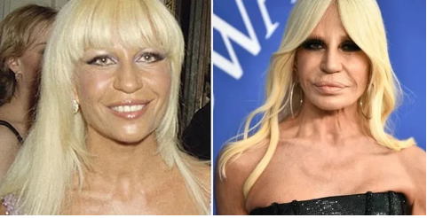 „Trudno w to uwierzyć, ale była piękna”: jak wyglądała włoska projektantka mody Donatella Versace przed operacją plastyczną?