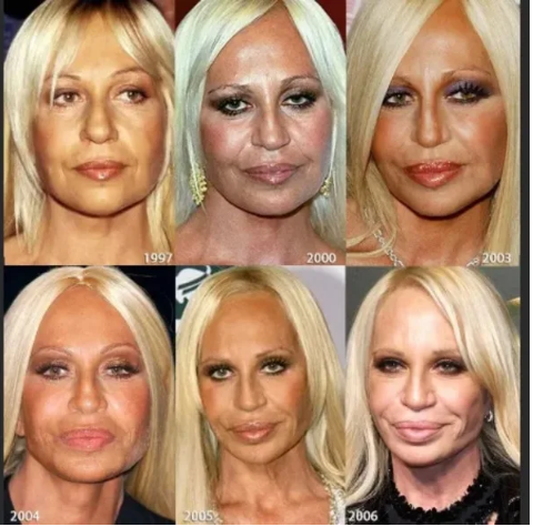 „Trudno w to uwierzyć, ale była piękna”: jak wyglądała włoska projektantka mody Donatella Versace przed operacją plastyczną?