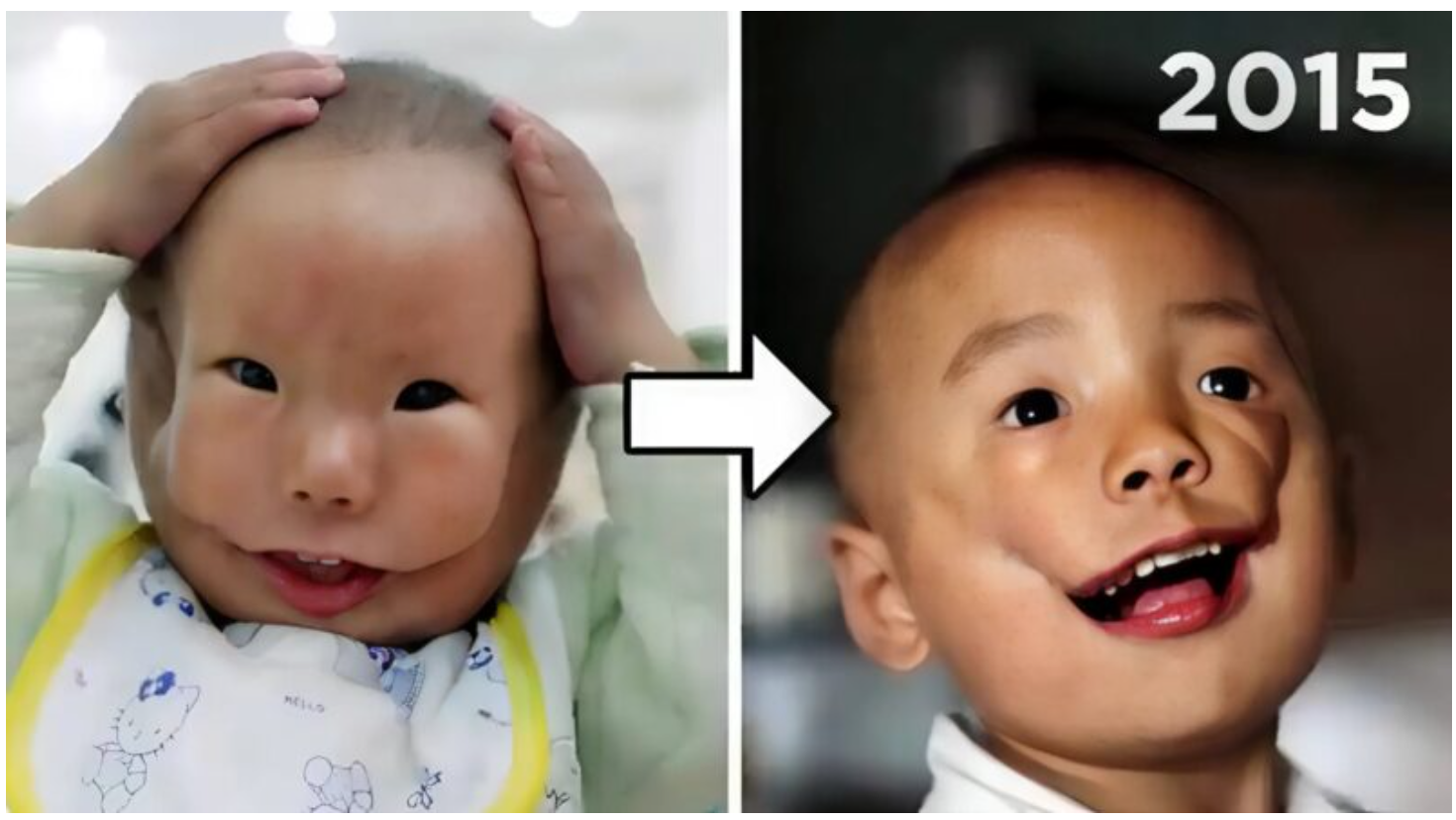 Chińska medycyna nie rezygnuje nawet z najbardziej niecodziennych przypadków…