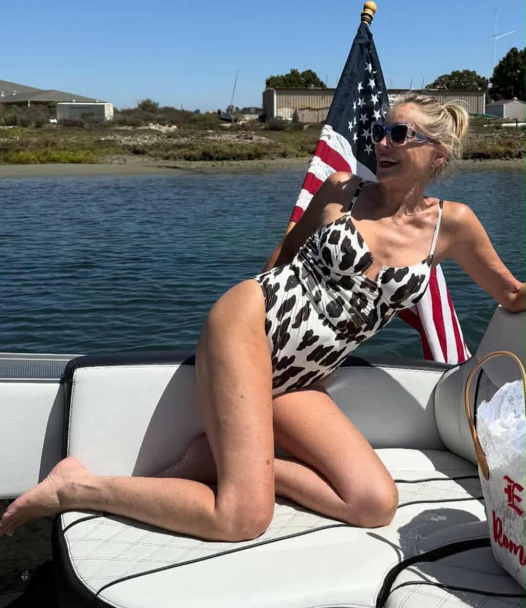 Stone ma przebarwienia i zwiotczałą skórę, więc fani błagają ją, aby była mądra.