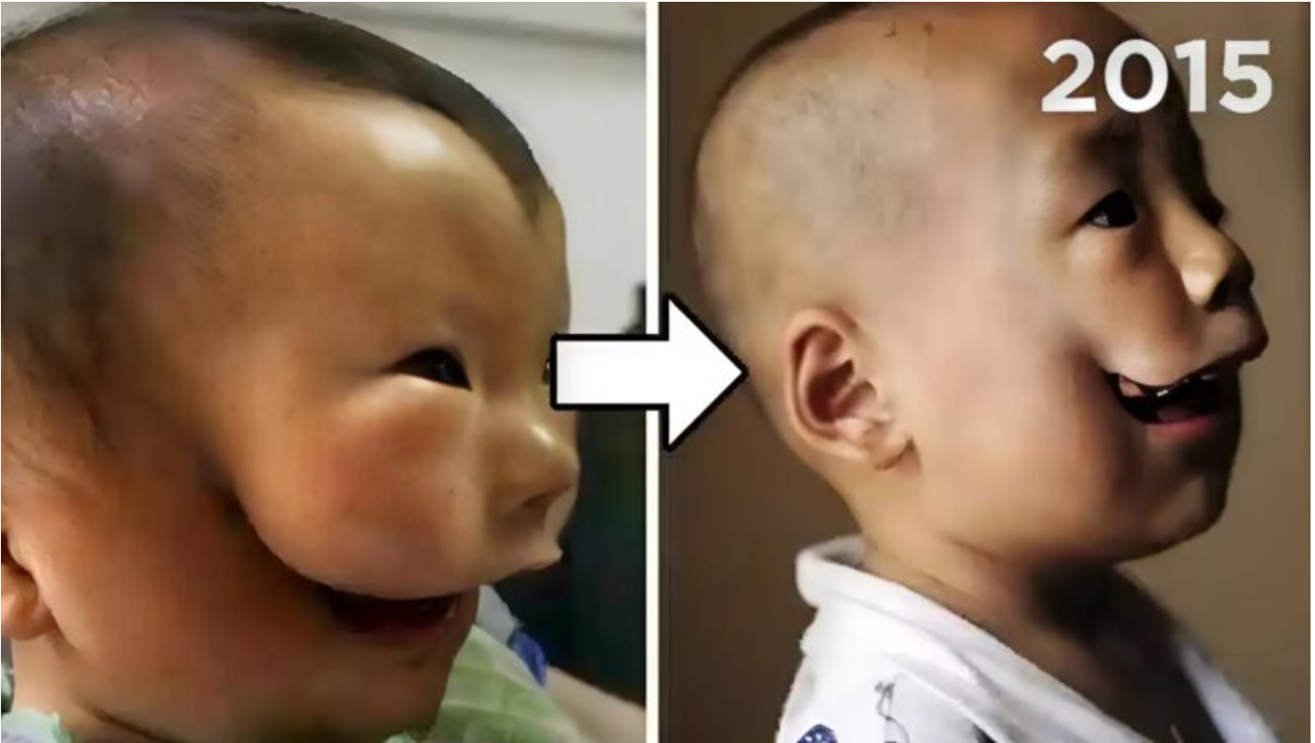 Chińska medycyna nie rezygnuje nawet z najbardziej niecodziennych przypadków…