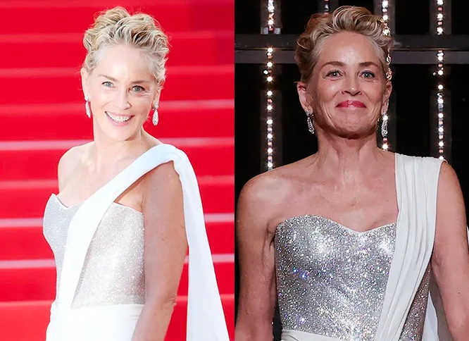 Różnica jest ogromna! Szczere zdjęcia gwiazd z mediów społecznościowych i z czerwonego dywanu