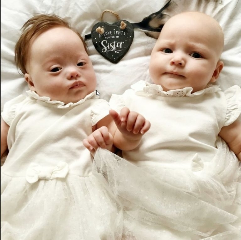 Bliźniaczki z prawdopodobieństwem jeden do miliona: jedna ma zespół Downa, druga nie!