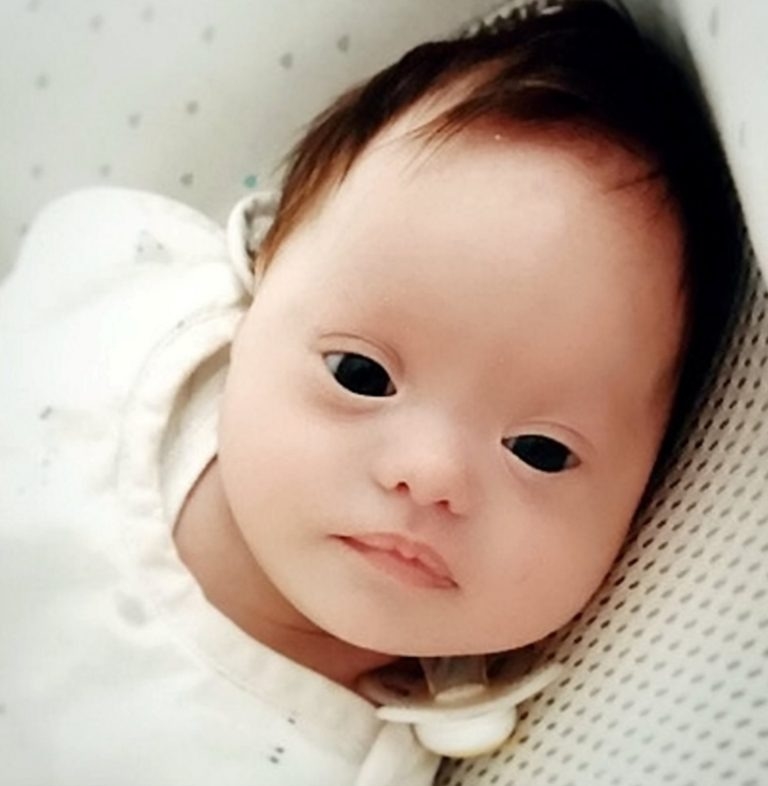 Bliźniaczki z prawdopodobieństwem jeden do miliona: jedna ma zespół Downa, druga nie!