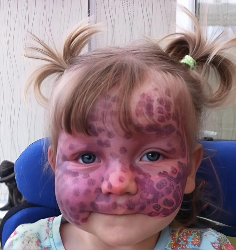 Nawet trudną chorobę można pokonać, jeśli się nie poddaje.