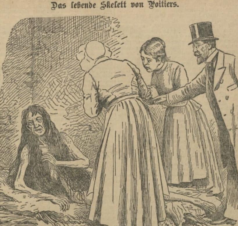 Blanche Monnier: Dziewczyna, która była zamknięta przez 25 lat